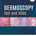 Dermoscopy: Text and Atlas (Color)
