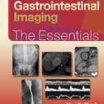 Gastrointestinal Imaging: The Essentials (Color)