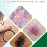 Skin Cancer: A Comprehensive Guide (Color)