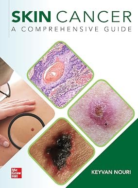 71KTXjLYIlL._SY385_ Skin Cancer: A Comprehensive Guide (Color) - Image 1