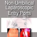 NON-UMBILICAL LAPAROSCOPIC ENTRY PORTs (Color)