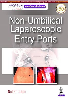 81S9RXtS6IL._SY385_ NON-UMBILICAL LAPAROSCOPIC ENTRY PORTs (Color) - Image 1