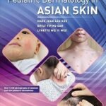 Atlas of Pediatric Dermatology in Asian Skin (Color)
