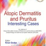 Atopic Dermatitis and Pruritus: Interesting Cases (Color)
