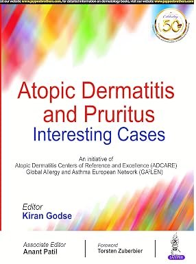 81xcjFYe4OL._SY385_ Atopic Dermatitis and Pruritus: Interesting Cases (Color) - Image 1