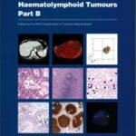 Haematolymphoid Tumours: Who Classification of Tumours Part B (Color)