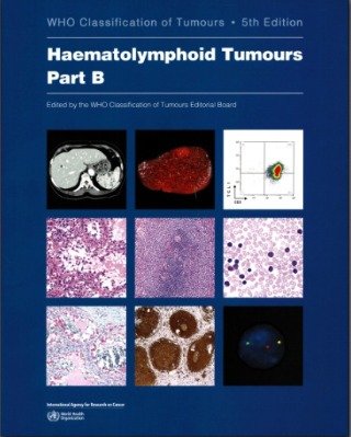WhatsApp Image 2026-08-29 at 5.32.22 PM Haematolymphoid Tumours: Who Classification of Tumours Part B (Color) - Image 1