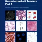 Haematolymphoid Tumours: Who Classification of Tumours Part A (Color)
