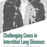 Challenging Cases in Interstitial Lung Diseases (Color)