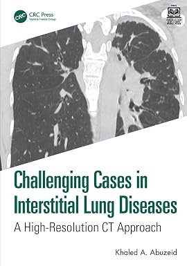61CEEkDae+L._SY385_ Challenging Cases in Interstitial Lung Diseases (Color) - Image 1