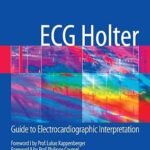 ECG Holter: Guide to Electrocardiographic Interpretation (B&W)