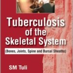 Tuberculosis Of The Skeletal System (Color)