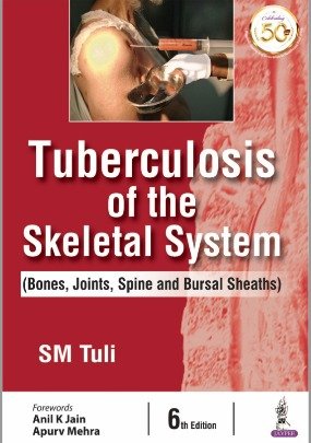 WhatsApp Image 2026-09-03 at 5.28.03 PM Tuberculosis Of The Skeletal System (Color) - Image 1