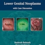 Comprehensive Review of Lower Genital Neoplasms with Case Discussion (Color)