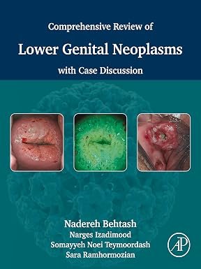 71TGGw8VCXL._SY385_ Comprehensive Review of Lower Genital Neoplasms with Case Discussion (Color) - Image 1