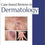 Case-based Reviews in Dermatology (Color)