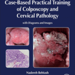 Case-Based Practical Training of Colposcopy and Cervical Pathology: With Diagrams and Images (Color)