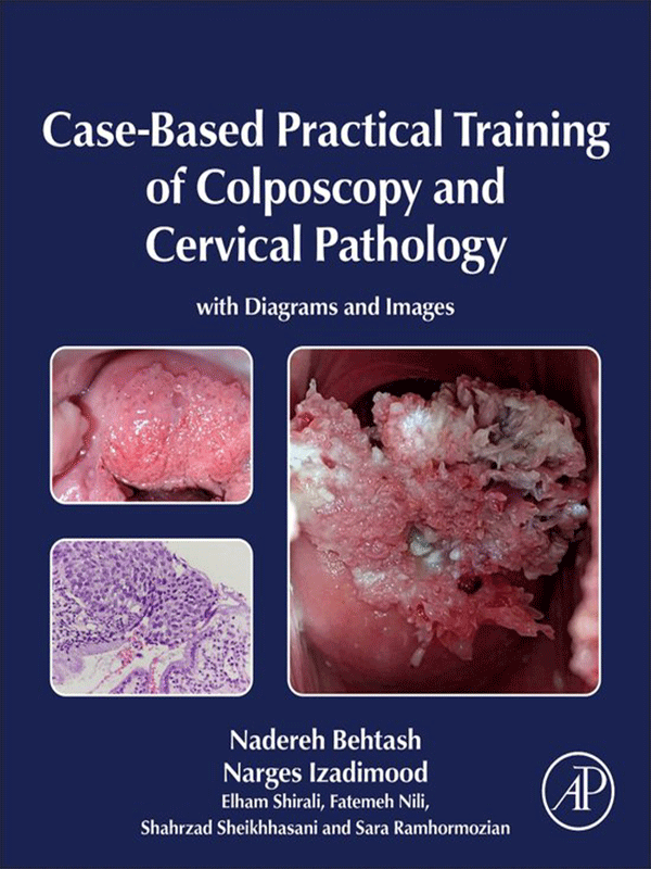 Case-Based-Practical-Training-of-Colposcopy-and-Cervical-Pathology-With-Diagrams-and-Images Case-Based Practical Training of Colposcopy and Cervical Pathology: With Diagrams and Images (Color) - Image 1